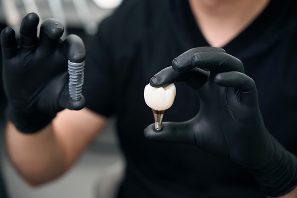 How A Dentist Uses Dental Implants To Replace A Missing Tooth